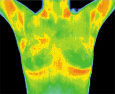 termogram bazowy